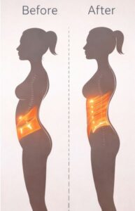 ティラピスのエクセサイズの前ろ後の画像